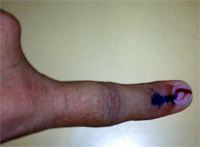 Voting Mark in Finger - Tamilnadu State Elections May 2006